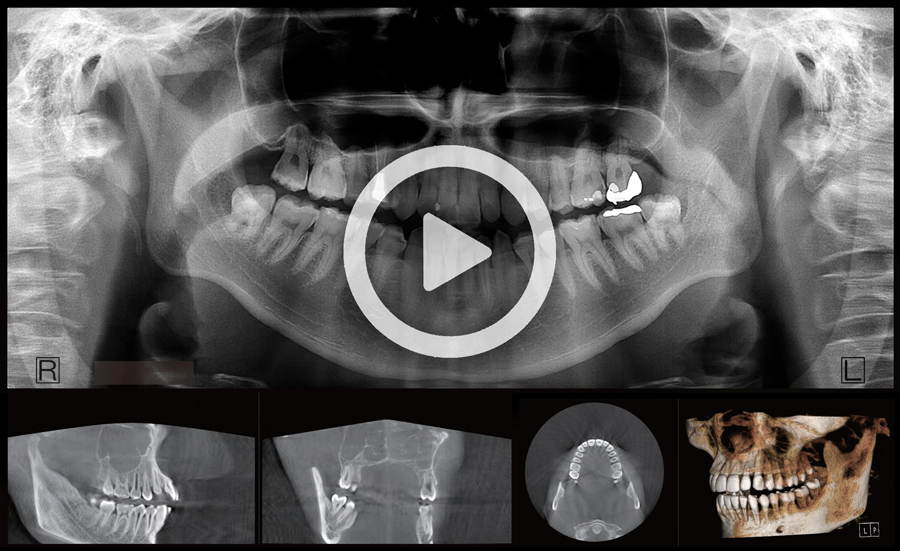 XERA X-Rays